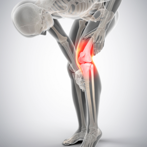 specialized in arthritis management